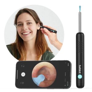 گوش پاک کن هوشمند Bebird R1+ | دارای دوربین HD 8MP